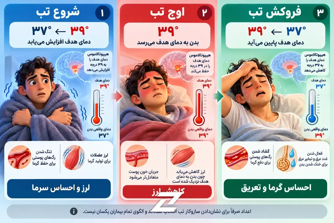 نمودار مراحل تب شامل شروع لرز، اوج دمای بدن و فروکش کردن تب