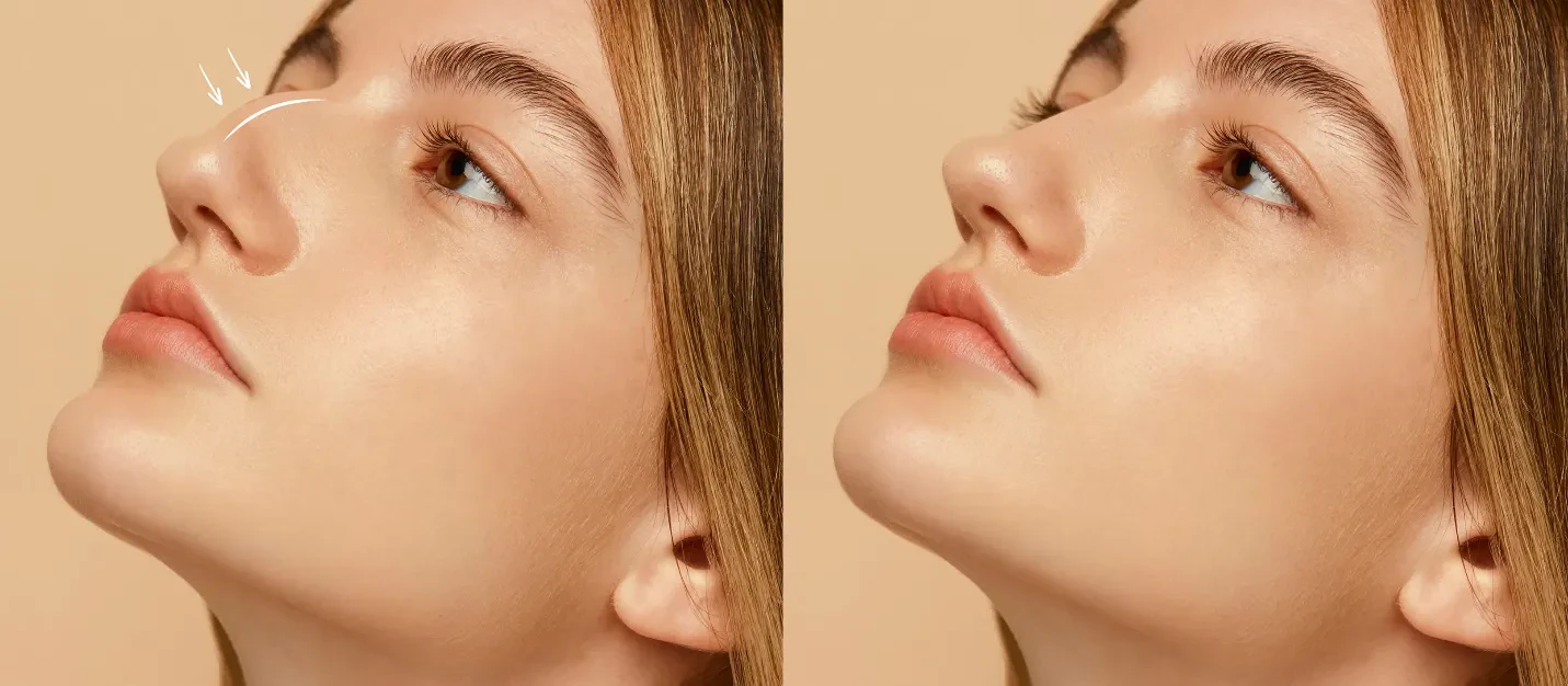 چگونه جراح بینی را انتخاب کنیم؟ 7 معیار مهم قبل از رینوپلاستی