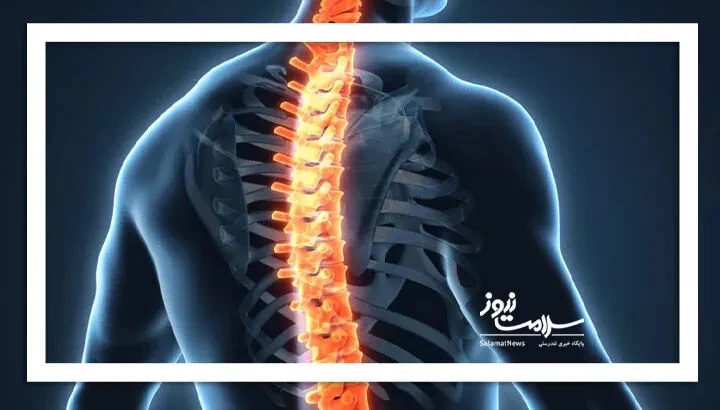 بهبود درد پس از عفونت جراحی ستون فقرات به معنای رفع خطر عوارض نیست